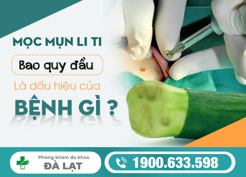 Hình ảnh minh họa